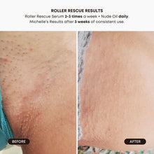 Load image into Gallery viewer, Bushbalm - Roller Rescue Ingrown Hair Soothing Serum