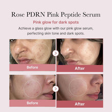 Load image into Gallery viewer, PDRN Pink Peptide Serum