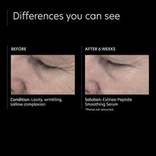 Load image into Gallery viewer, ExLinea® Peptide Smoothing Serum