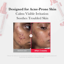 Load image into Gallery viewer, Best Beauty Group - MEDICUBE Hypochlorous Acid Daily Facial Spray
