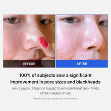 Load image into Gallery viewer, Medicube Zero Pore Pads
