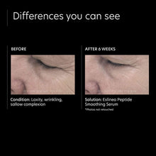 Load image into Gallery viewer, ExLinea® Peptide Smoothing Serum
